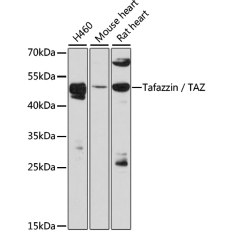 Western Blot - Anti-Tafazzin/TAZ Antibody (A90248) - Antibodies.com