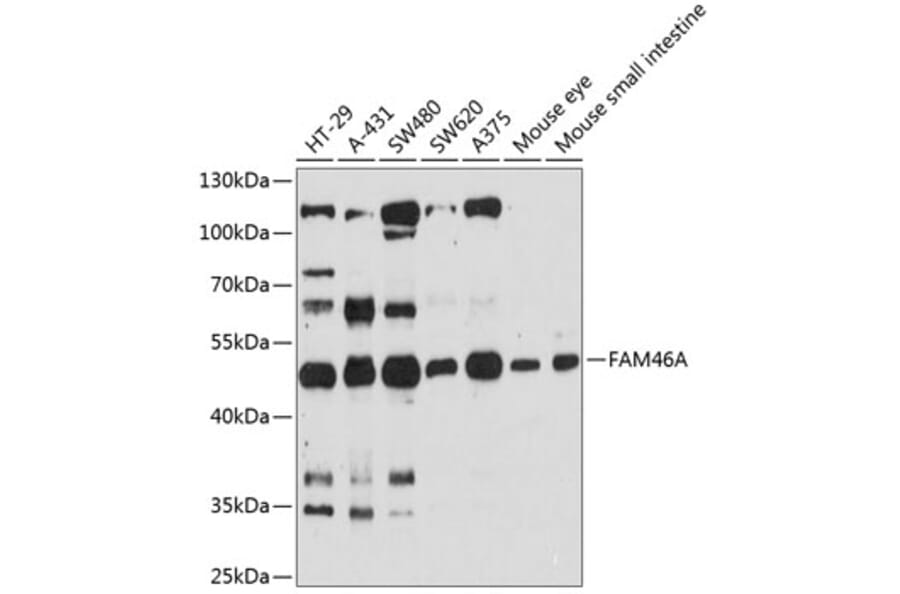 Western Blot - Anti-FAM46A Antibody (A90250) - Antibodies.com