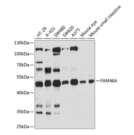 Western Blot - Anti-FAM46A Antibody (A90250) - Antibodies.com