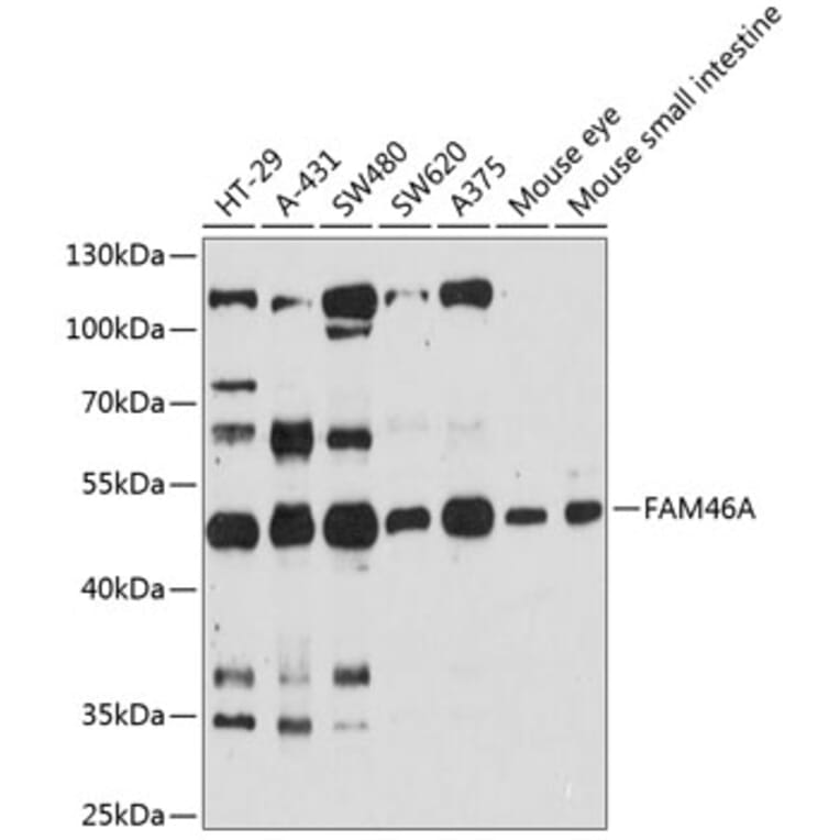 Western Blot - Anti-FAM46A Antibody (A90250) - Antibodies.com
