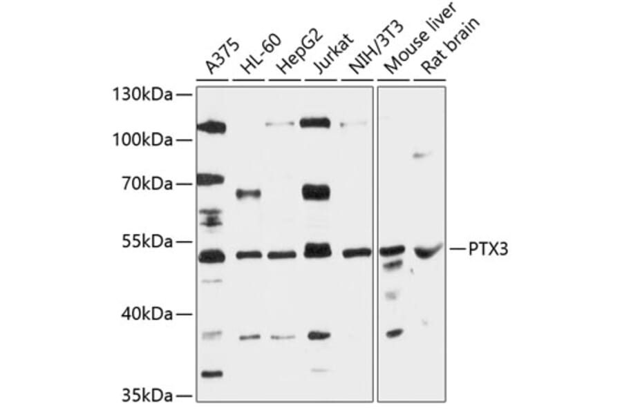 Western Blot - Anti-Pentraxin 3/PTX3 Antibody (A90251) - Antibodies.com