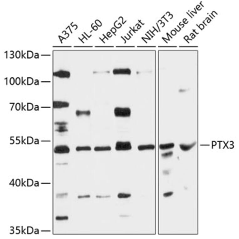 Western Blot - Anti-Pentraxin 3/PTX3 Antibody (A90251) - Antibodies.com