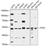 Western Blot - Anti-Pentraxin 3/PTX3 Antibody (A90251) - Antibodies.com