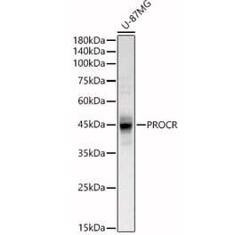 Western Blot - Anti-EPCR/CD201 Antibody (A90252) - Antibodies.com