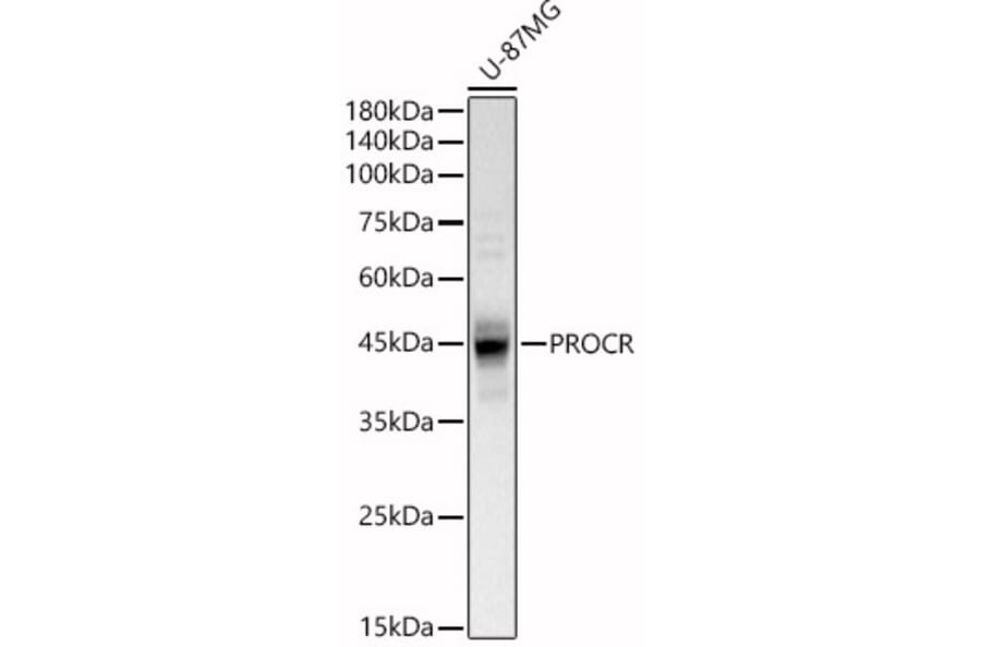 Western Blot - Anti-EPCR/CD201 Antibody (A90252) - Antibodies.com