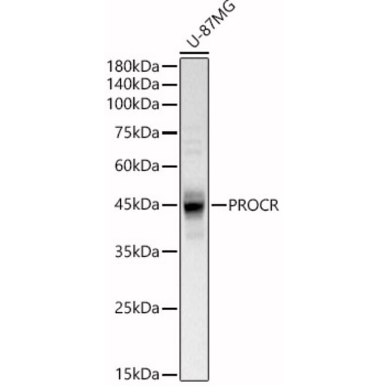 Western Blot - Anti-EPCR/CD201 Antibody (A90252) - Antibodies.com