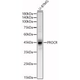 Western Blot - Anti-EPCR/CD201 Antibody (A90252) - Antibodies.com