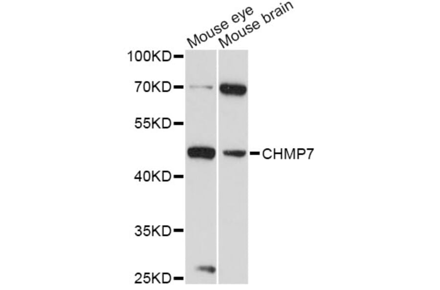 Western Blot - Anti-CHMP7 Antibody (A14334) - Antibodies.com