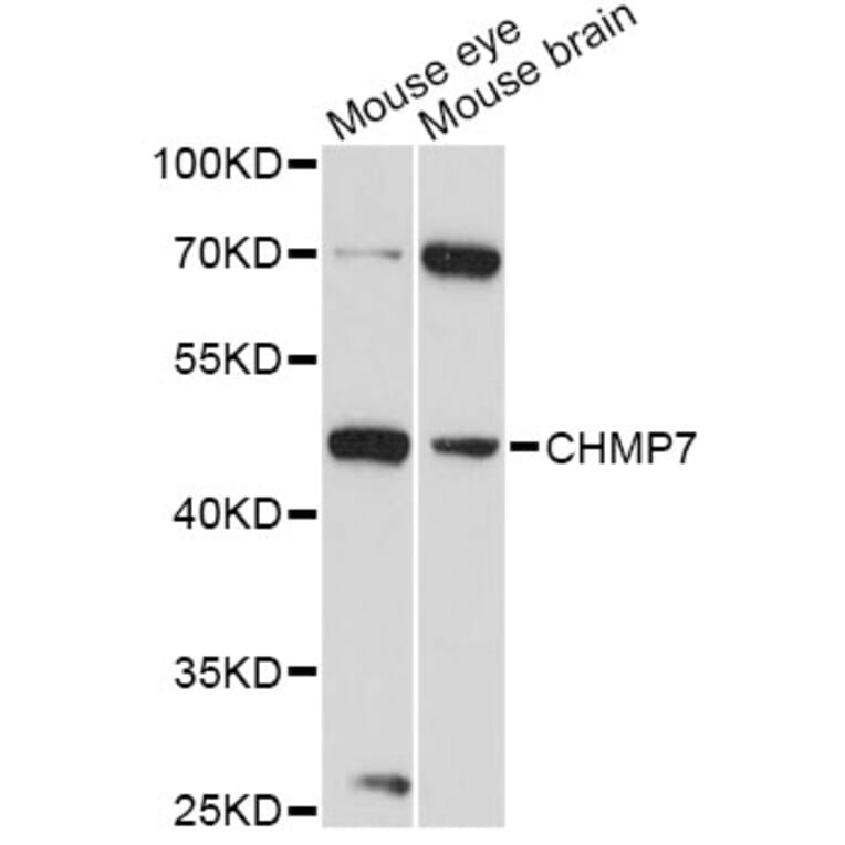 Western Blot - Anti-CHMP7 Antibody (A14334) - Antibodies.com