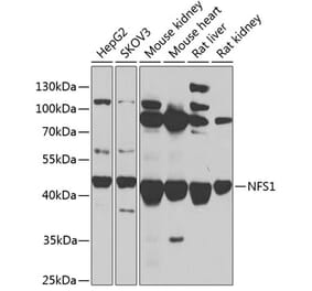 Western Blot - Anti-NFS1 Antibody (A90256) - Antibodies.com