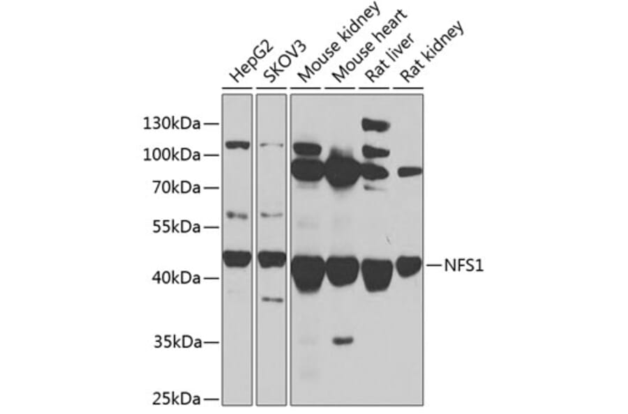 Western Blot - Anti-NFS1 Antibody (A90256) - Antibodies.com