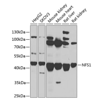 Western Blot - Anti-NFS1 Antibody (A90256) - Antibodies.com