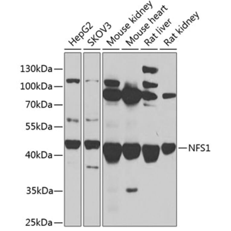 Western Blot - Anti-NFS1 Antibody (A90256) - Antibodies.com