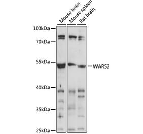 Western Blot - Anti-WARS2 Antibody (A90257) - Antibodies.com