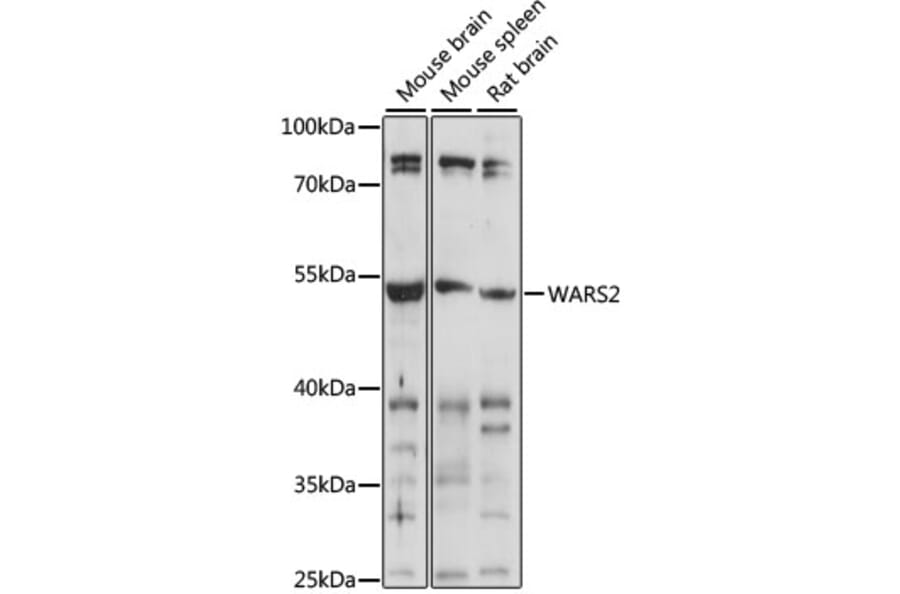 Western Blot - Anti-WARS2 Antibody (A90257) - Antibodies.com