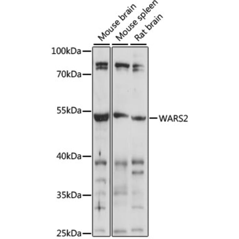 Western Blot - Anti-WARS2 Antibody (A90257) - Antibodies.com