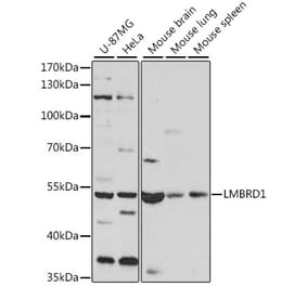 Western Blot - Anti-LMBRD1 Antibody (A90258) - Antibodies.com