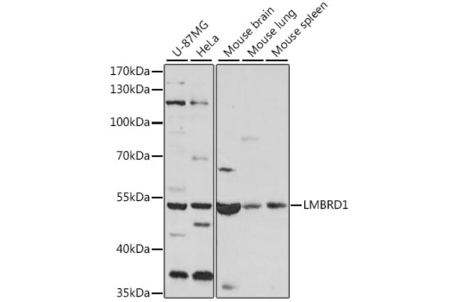 Western Blot - Anti-LMBRD1 Antibody (A90258) - Antibodies.com