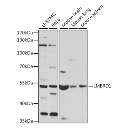 Western Blot - Anti-LMBRD1 Antibody (A90258) - Antibodies.com