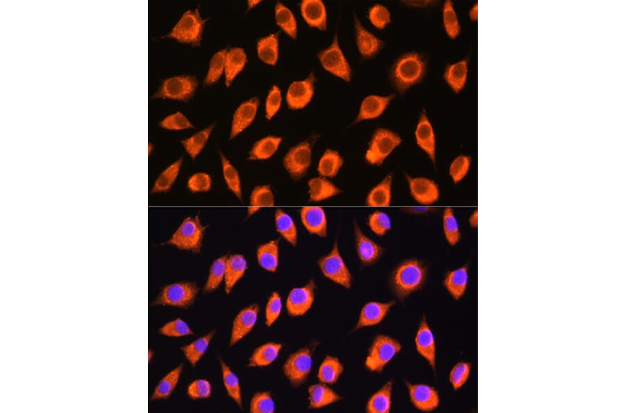 Immunofluorescence - Anti-LMBRD1 Antibody (A90258) - Antibodies.com