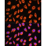 Immunofluorescence - Anti-LMBRD1 Antibody (A90258) - Antibodies.com