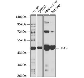 Western Blot - Anti-HLA E Antibody (A90259) - Antibodies.com