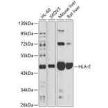 Western Blot - Anti-HLA E Antibody (A90259) - Antibodies.com