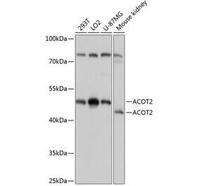 Western Blot - Anti-acyl-CoA Thioesterase 2 Antibody (A90260) - Antibodies.com