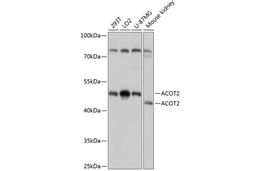 Western Blot - Anti-acyl-CoA Thioesterase 2 Antibody (A90260) - Antibodies.com