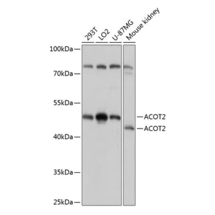 Western Blot - Anti-acyl-CoA Thioesterase 2 Antibody (A90260) - Antibodies.com