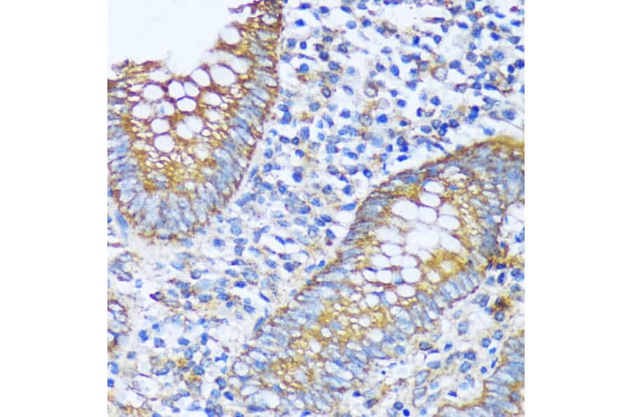 Immunohistochemistry - Anti-acyl-CoA Thioesterase 2 Antibody (A90260) - Antibodies.com