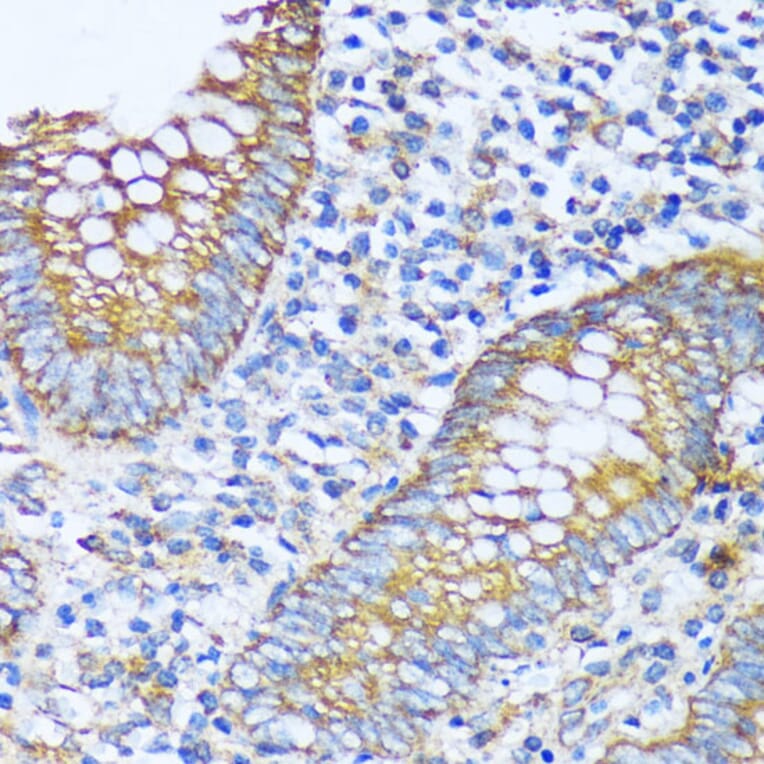 Immunohistochemistry - Anti-acyl-CoA Thioesterase 2 Antibody (A90260) - Antibodies.com