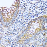Immunohistochemistry - Anti-acyl-CoA Thioesterase 2 Antibody (A90260) - Antibodies.com
