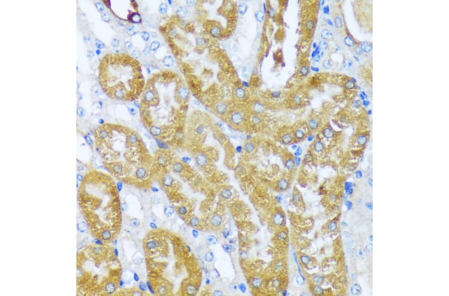 Immunohistochemistry - Anti-acyl-CoA Thioesterase 2 Antibody (A90260) - Antibodies.com