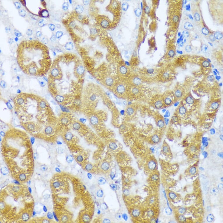 Immunohistochemistry - Anti-acyl-CoA Thioesterase 2 Antibody (A90260) - Antibodies.com
