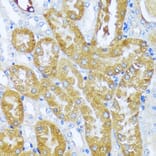 Immunohistochemistry - Anti-acyl-CoA Thioesterase 2 Antibody (A90260) - Antibodies.com