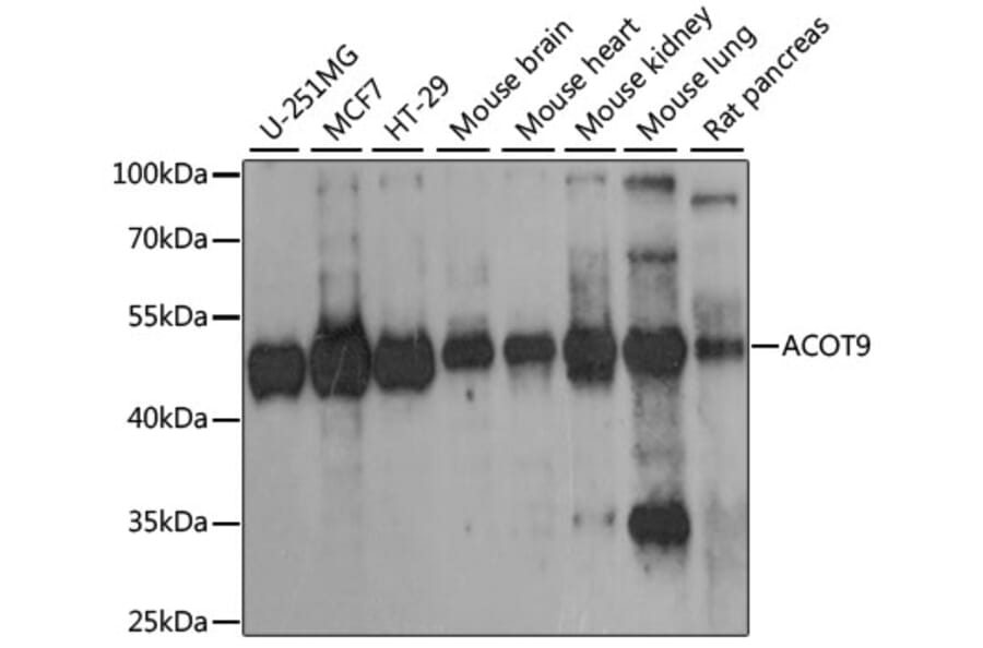 Western Blot - Anti-Acyl-CoA Thioesterase 9 Antibody (A90261) - Antibodies.com