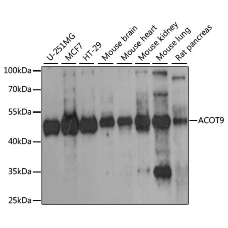 Western Blot - Anti-Acyl-CoA Thioesterase 9 Antibody (A90261) - Antibodies.com