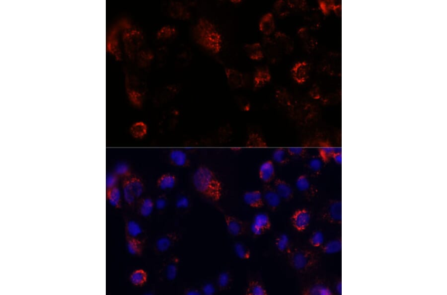 Immunofluorescence - Anti-Acyl-CoA Thioesterase 9 Antibody (A90261) - Antibodies.com