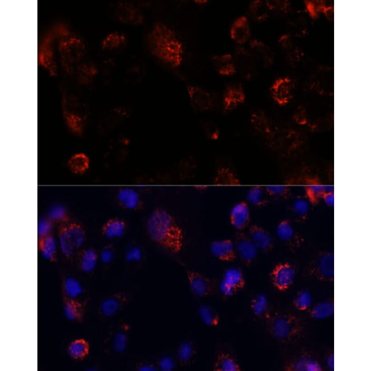 Immunofluorescence - Anti-Acyl-CoA Thioesterase 9 Antibody (A90261) - Antibodies.com