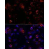 Immunofluorescence - Anti-Acyl-CoA Thioesterase 9 Antibody (A90261) - Antibodies.com