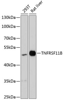 Western blot analysis of extracts of various cell lines, using Anti-TNFRSF11B Antibody (A13250) at 1:1,000 dilution.
Secondary antibody: Goat Anti-Rabbit IgG (H+L) (HRP) (AS014) at 1:10,000 dilution.
Lysates / proteins: 25µg per lane.
Blocking buffer: 3% non-fat dry milk in TBST.
Detection: ECL Enhanced Kit (RM00021).
Exposure time: 90s.