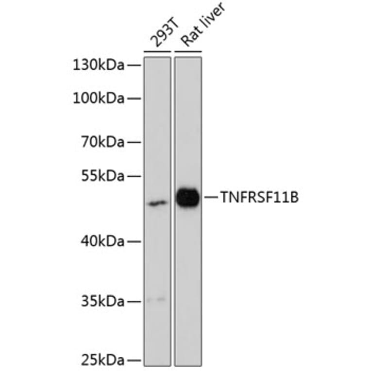 Western Blot - Anti-Osteoprotegerin Antibody (A90262) - Antibodies.com