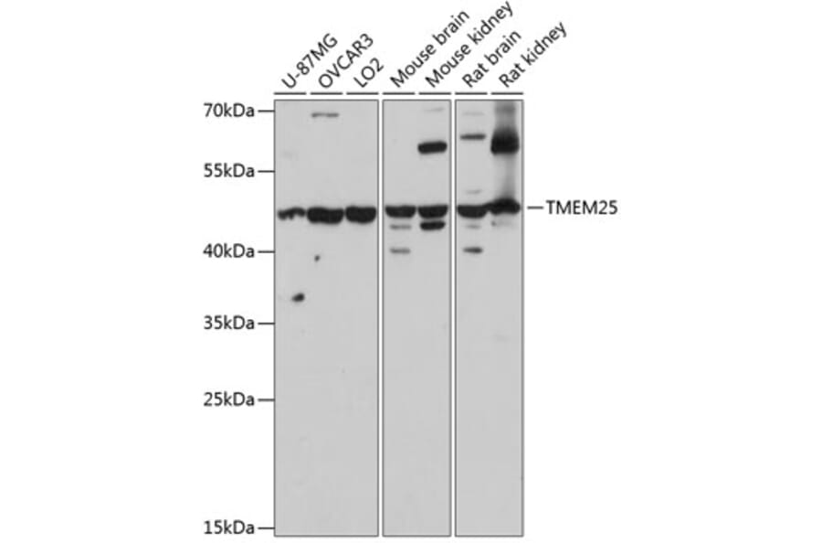 Western Blot - Anti-TMEM25 Antibody (A90263) - Antibodies.com
