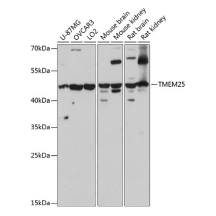 Western Blot - Anti-TMEM25 Antibody (A90263) - Antibodies.com