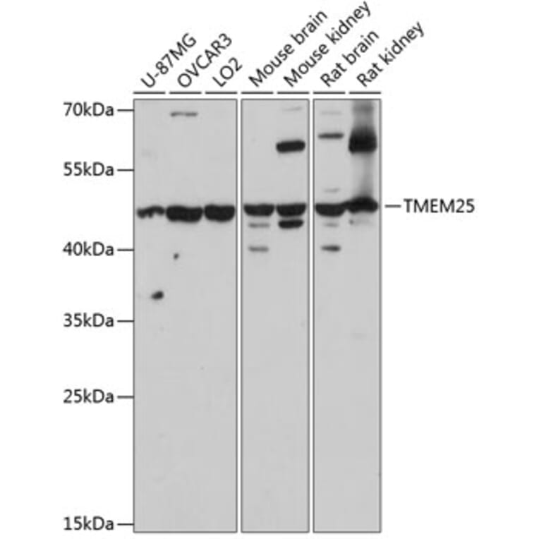 Western Blot - Anti-TMEM25 Antibody (A90263) - Antibodies.com