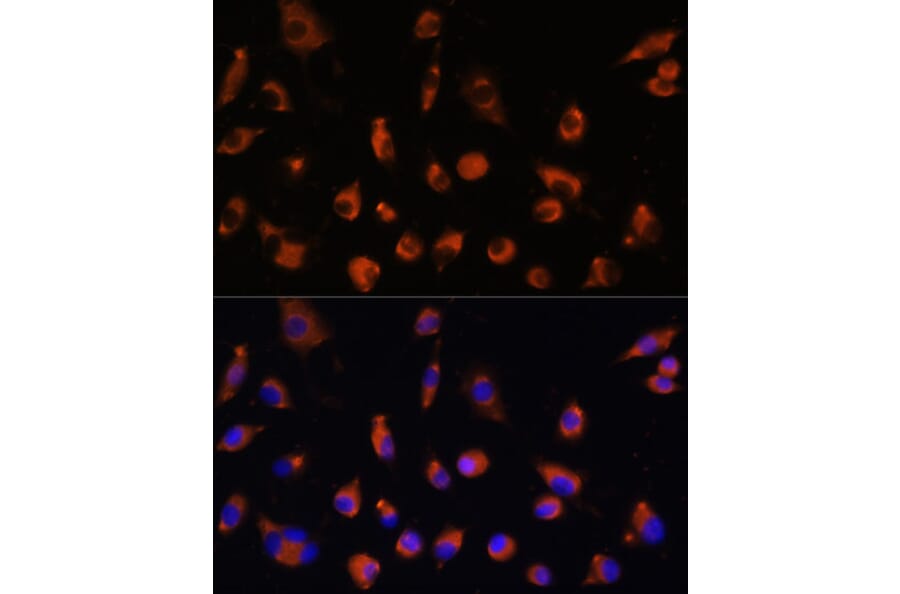 Immunofluorescence - Anti-TMEM25 Antibody (A90263) - Antibodies.com