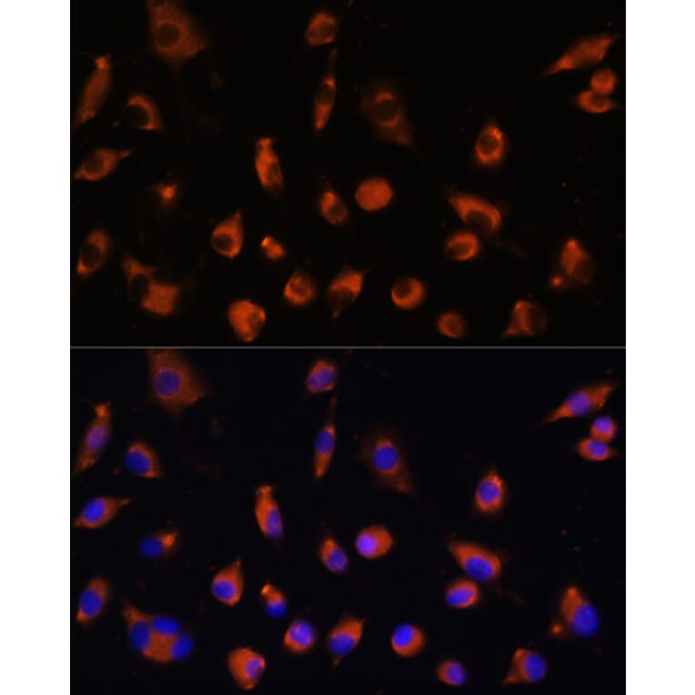 Immunofluorescence - Anti-TMEM25 Antibody (A90263) - Antibodies.com