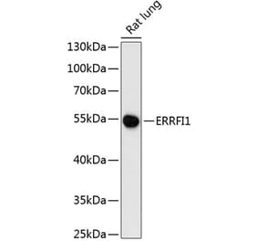 Western Blot - Anti-MIG-6 Antibody (A90264) - Antibodies.com