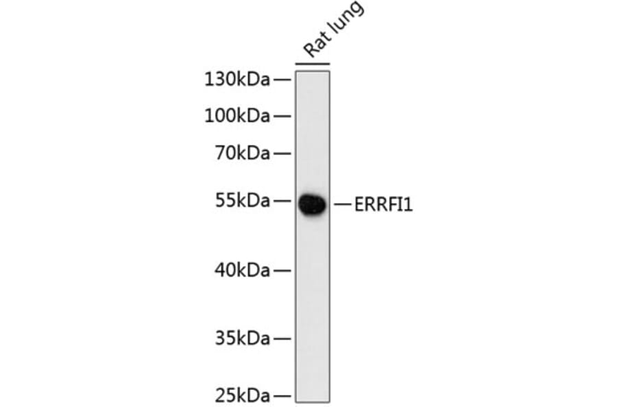 Western Blot - Anti-MIG-6 Antibody (A90264) - Antibodies.com